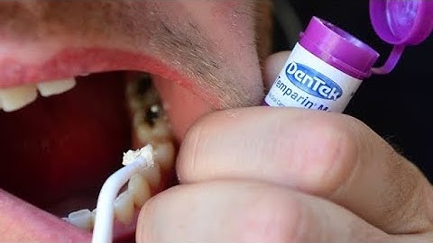 How To Fix a Broken Tooth with Dentemp or DenTek Tooth, Filling and Crown Repair