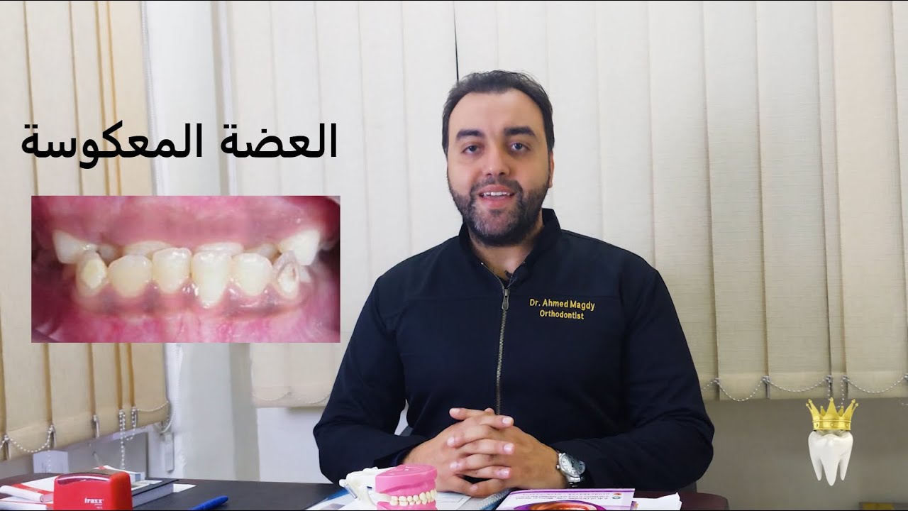 العضة المعكوسة في الأطفال - دكتور احمد مجدي