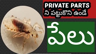 pubic lice.... చాలా చిరాకు పుట్టించేవి... ఇవి జననాంగాల దగ్గర ఉంటాయి 