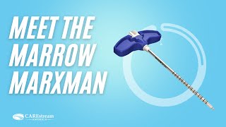 Meet the Marrow Marxman™ - A Flexible Bone Marrow Aspiration Solution