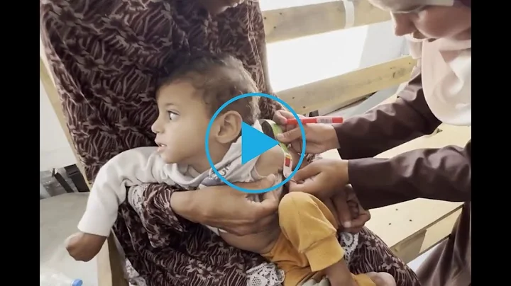 Otroci v Gazi stradajo, terapevtske hrane pa zmanjkuje │ SMS OTROCI10 NA 1919