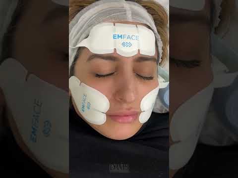 Video: Emsculpt strânge pielea?