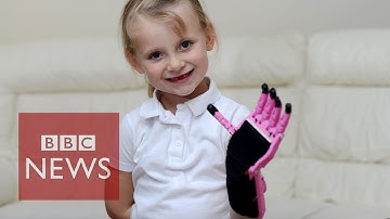 Girl gets 3D-printed prosthetic hand - BBC News