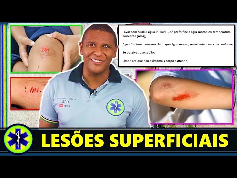 Vídeo: Primeiros Socorros Para Ferimentos Domésticos