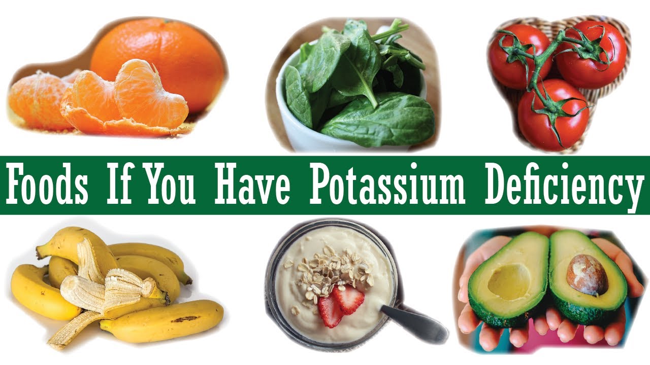 10 Foods If You Have Potassium Deficiency. YouTube
