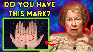 REVEALED: The True Meaning of the Half Moon Mark on the Palm! by ✨ Dolores Cannon