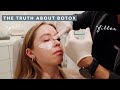 Finally Opening Up About My Botox And Filler! | Vlogmas Day 19!