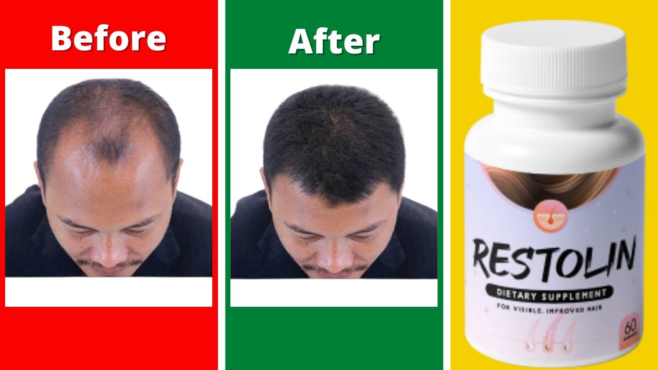 Restoline Reviews | Restolin Honest Review | Restolin Supplement Review | My Honest Opinion Restolin