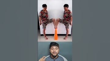 Faded Song | Disable Conjoined Women#viralshorts#shorts#ytshorts#viral