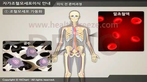 [시연용] c0053aako 자가조혈모세포이식 안내