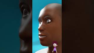 Can Your Eyeballs Fall Out? Doctors Explain