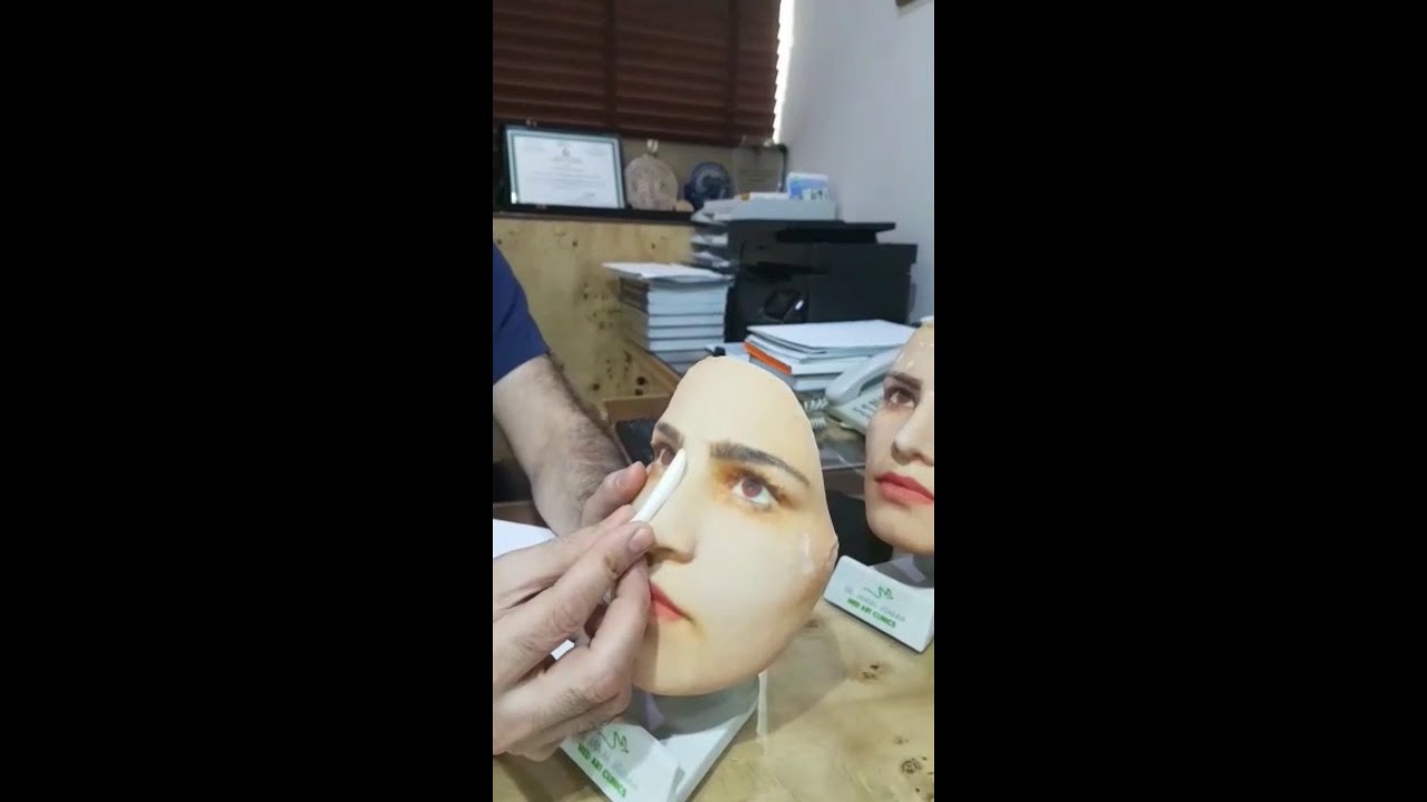 عمليات تجميل الانف والفرق بين الغضروف الطبيعي والصناعي - دكتور جمال جمعه - عيادات اجمل