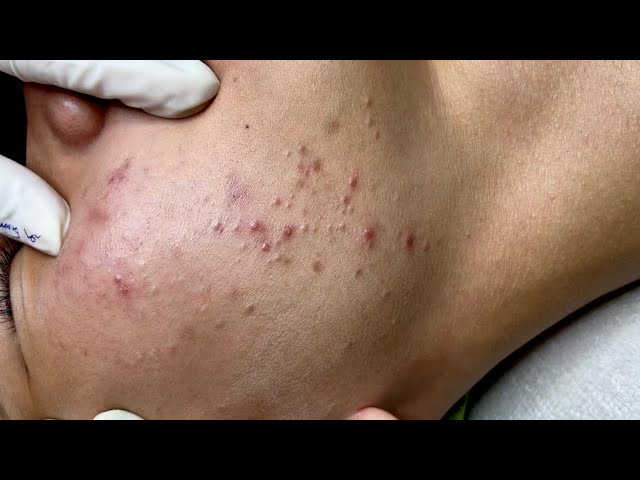 Satisfying video with Chung Vo Spa | 194