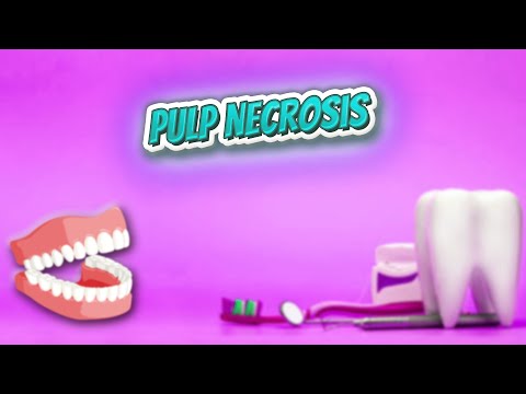 Video: Pulp Necrosis: Gejala, Tes, Penyebab, Risiko, Dan Perawatan