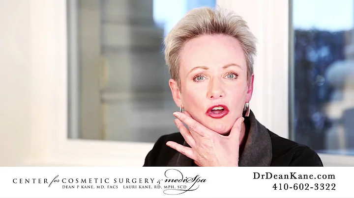 Sculptra Patient Story | Deborah Murray