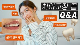 치아교정 끝!!🦷 교정 Q&A 후기 총정리 (충격적인 전후사진 공개, 얼굴변화, 총 비용💵, 장단점, 통증, 종류)