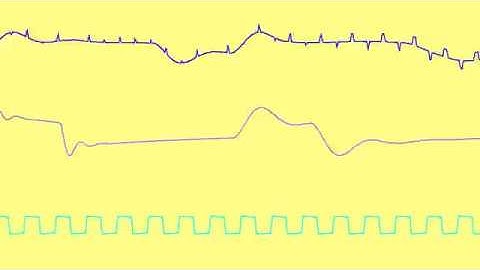 COMMODORE C64 SID - ENTER THE NINJA - SASCHA ZEIDLER/LINUS (Oscilloscope View)