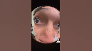 ضحك حتى الموت 