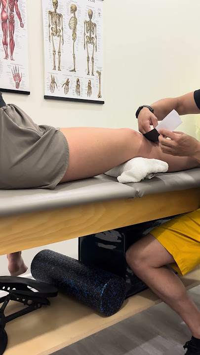 K-taping for IT band issues #ktape #itband #chronicpain #pt