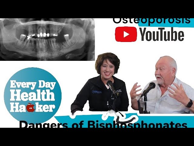 Bisphosphonates the Dangers of Side Effects and Loosing Teeth Part II
