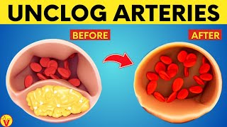 Top 11 Foods to Clean Your Arteries And Prevent Heart Attacks | VisitJoy by VisitJoy 1,350 views 10 days ago 12 minutes, 51 seconds