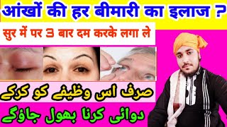 Aankhon Ki Bimari ka ilaj | आंखों की बीमारी का वजीफा / Eyes Rohani Treatment / By Aarif Raza Naimi