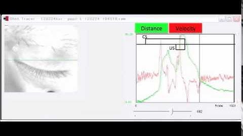 Implicit Memory in Monkeys: Development of a Delay Eyeblink Conditioning System with Parallel...