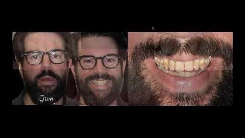 Monolithic, Micro Layered & Layered Lithium Silicate Disilicate Materials with Peter Pizzi, CDT, MDT