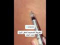 طريقة اعضاء الابرة تحت الجلد