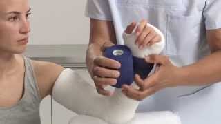 Plaster of Paris Elbow Splint Application