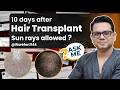 10 Days Post Hair Transplant: Is Sun Exposure Safe? Ask Me ft. Dr.Jangid