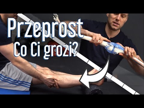 Wideo: 4 sposoby na naprawienie przeprostu kolan