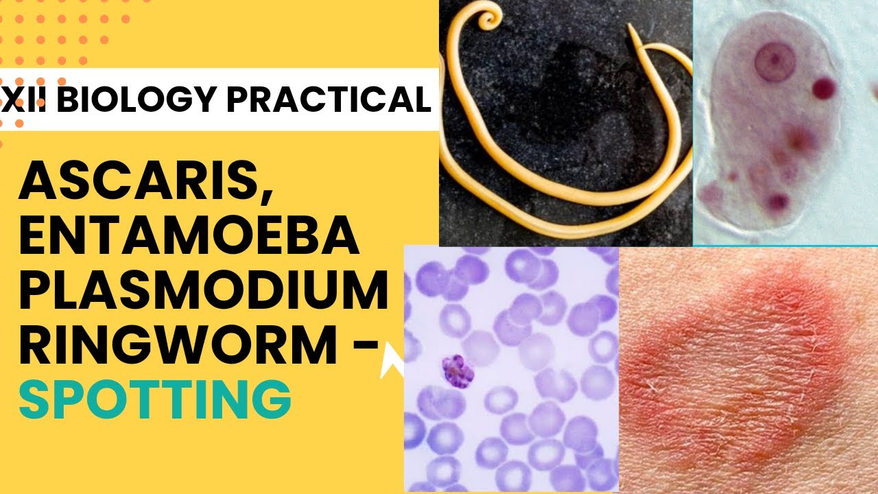 Spotting- Ascaris, Entamoeba, Plasmodium, Ringworm- Disease causing organisms/ XII Biology Practical