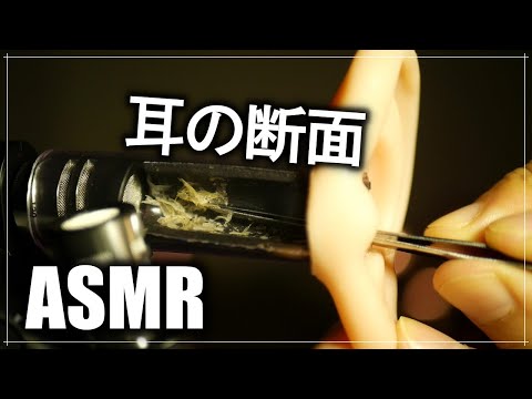 【ASMR耳かき】やっぱりピンセットが好き✨耳垢剥がし?Remove earwax with tweezers✨핀셋으로 귀지를 떼어／ No talking／おすすめ／視覚的ティングル