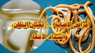 هل تعلم علامات وأعراض اصابتك بالديدان المعوية| شاهد اذا كنت مصاب