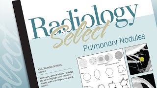 Radiology Select Volume 1: Pulmonary Nodules Specific Lung Nodules Masses Chest Radiology Essentials