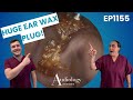 Deep Ear Wax Removal with Microsuction – Super Satisfying! - EP1155