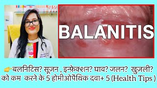 लिंग की सूज़न? इन्फ़ेक्शन? Balanitis 5 Best Homeopathic Medicine ! Candida Balanitis Treatment screenshot 4