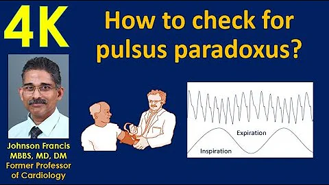 How to check for pulsus paradoxus?