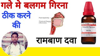 Post nasal drip (PND) homeopathic medicine