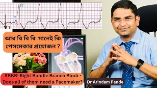 আর বি বি বি - মানেই কি পেসমেকার প্রয়োজন ? RBBB ! Right Bundle Branch Block - কি রোগ ? Dr A Pande.