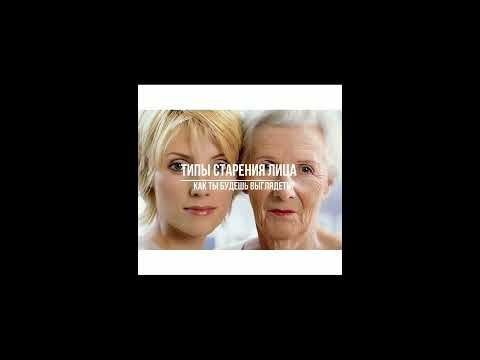 Деформационный тип старения.