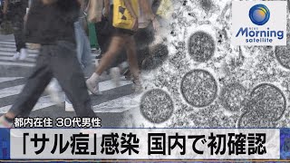 都内在住 30代男性　「サル痘」感染 国内で初確認【モーサテ】（2022年7月26日）