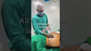 HD Liposuction in Pune | 9834655013