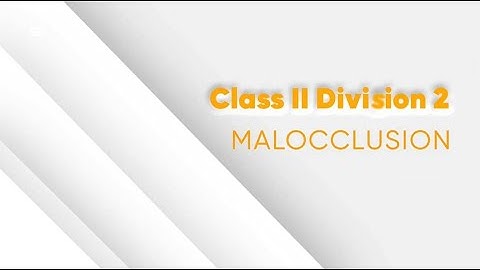 Class II Division 2 Malocclusion
