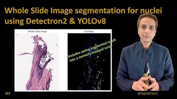 337 - Whole Slide Image segmentation for nuclei​ using Detectron2 and YOLOv8