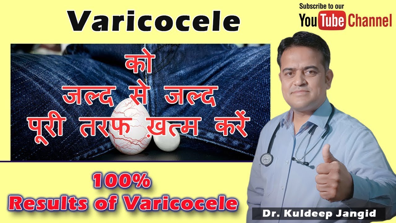 Varicocele का परमानेंट इलाज 100 treatment of Varicocele Best