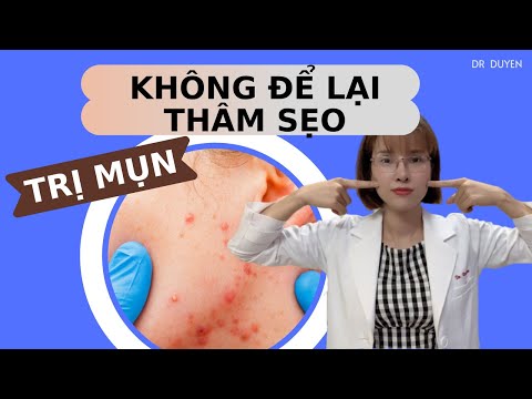 Làm cách nào để Trị Mụn không để lại thâm sẹo | Dr Duyên