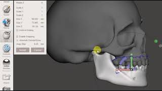 Temporomandibular Joint using meshmixer for making nightguard