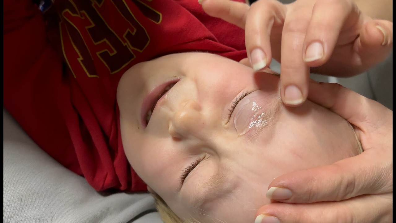 BULUT KÖTÜ DÜŞTÜ GÖZÜ DAVUL GİBİ ŞİŞTİ !! NE OLDU SANA BULUT BUĞLEM??